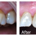 Before & After Photos