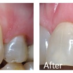 Before & After Photos