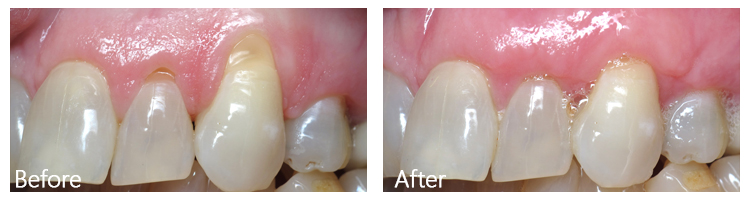 Before & After Photos