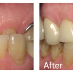 Before & After Photos