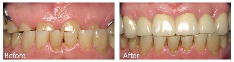 Before & After Photos