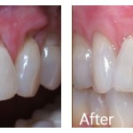Before & After Photos