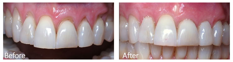 Before & After Photos