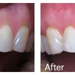 Before & After Photos