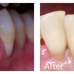 Before & After Photos