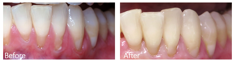 Before & After Photos
