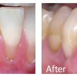 Before & After Photos