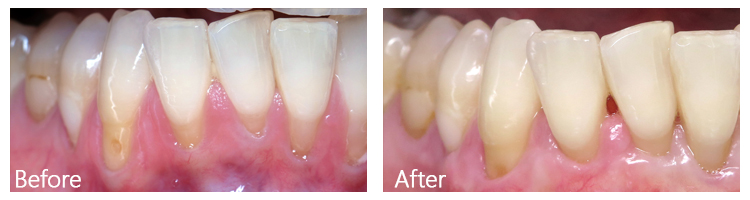 Before & After Photos