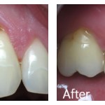 Before & After Photos