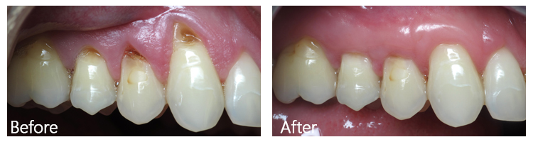 Before & After Photos