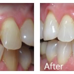 Before & After Photos