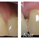 Before & After Photos