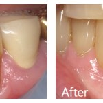 Before & After Photos