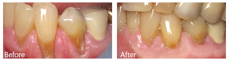 Before & After Photos