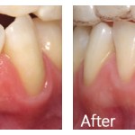 Before & After Photos