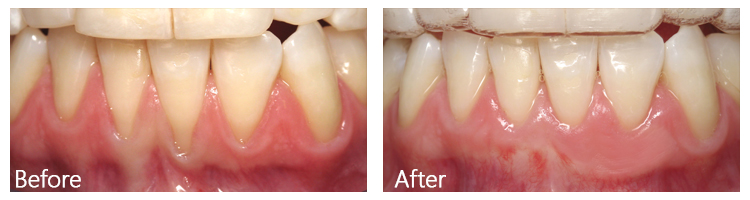 Before & After Photos