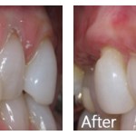 Before & After Photos