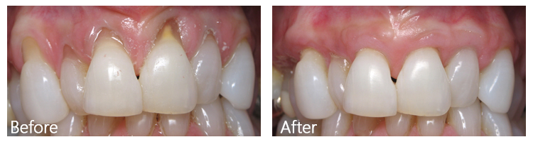 Before & After Photos