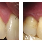 Before & After Photos