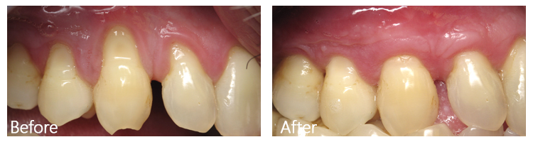 Before & After Photos
